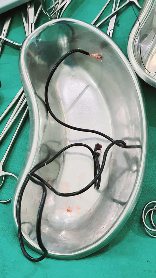 หนุ่มสอดสายชาร์จเข้าอวัยวะเพศ หนุ่มสอดสายชาร์จเข้าอวัยวะเพศ