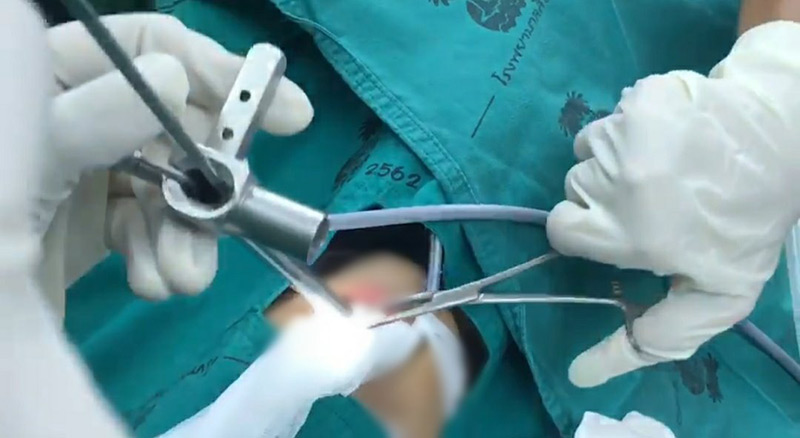 เหรียญติดคอเด็ก เหรียญติดคอเด็ก