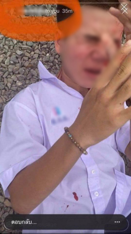 นักเรียนตีกัน นักเรียนตีกัน