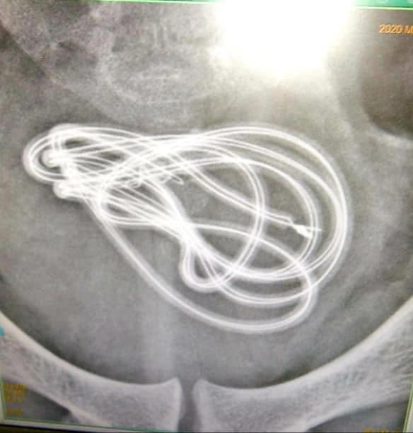 หนุ่มสอดสายชาร์จเข้าอวัยวะเพศ หนุ่มสอดสายชาร์จเข้าอวัยวะเพศ