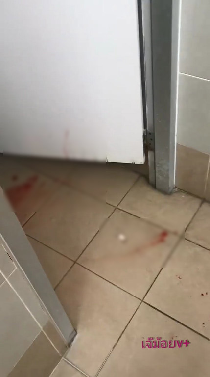 หลานโวยพยาบาล ถอดสายน้ำเกลือตาเลือดสาด หลานโวยพยาบาล ถอดสายน้ำเกลือตาเลือดสาด