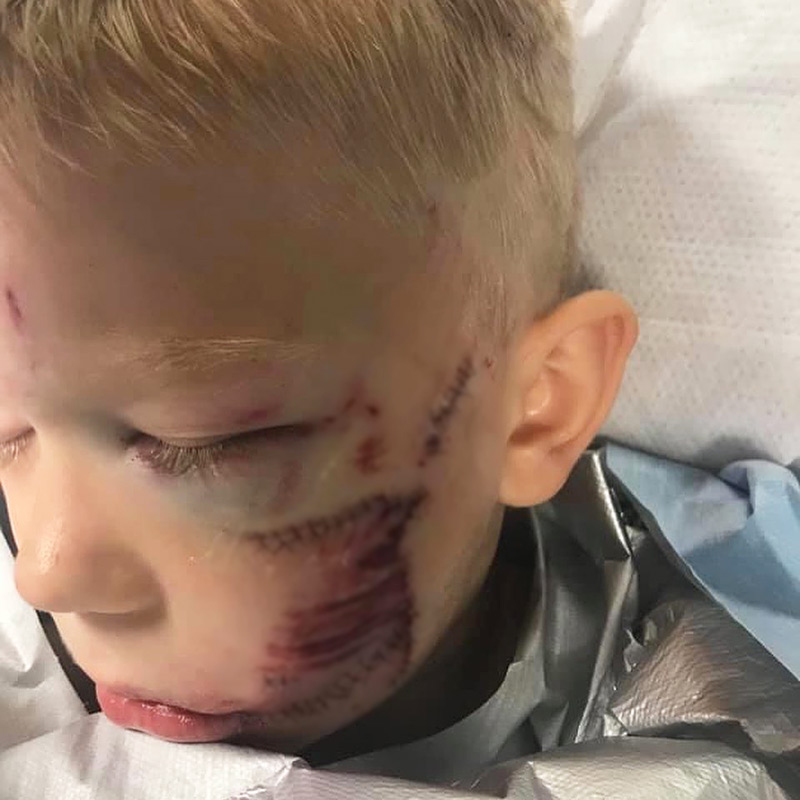 พี่ชายปกป้องน้องสาวไม่ให้ถูกสุนัขกัด พี่ชายปกป้องน้องสาวไม่ให้ถูกสุนัขกัด