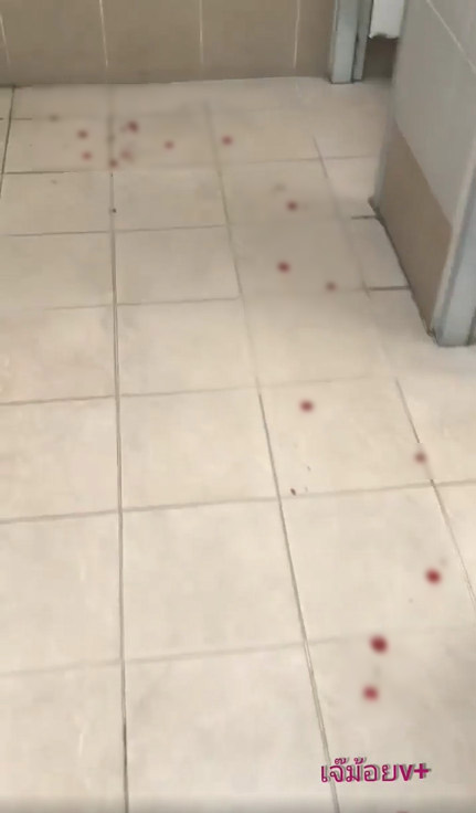 หลานโวยพยาบาล ถอดสายน้ำเกลือตาเลือดสาด หลานโวยพยาบาล ถอดสายน้ำเกลือตาเลือดสาด