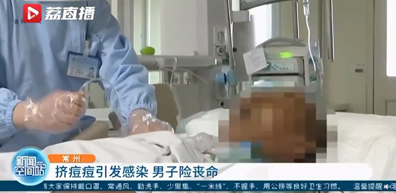 บีบสิว ป่วยหนักปางตาย บีบสิว ป่วยหนักปางตาย