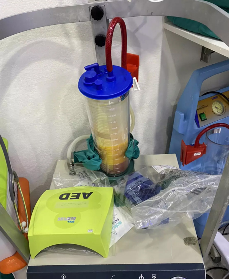 ดูดไขมันเสียชีวิต ดูดไขมันเสียชีวิต