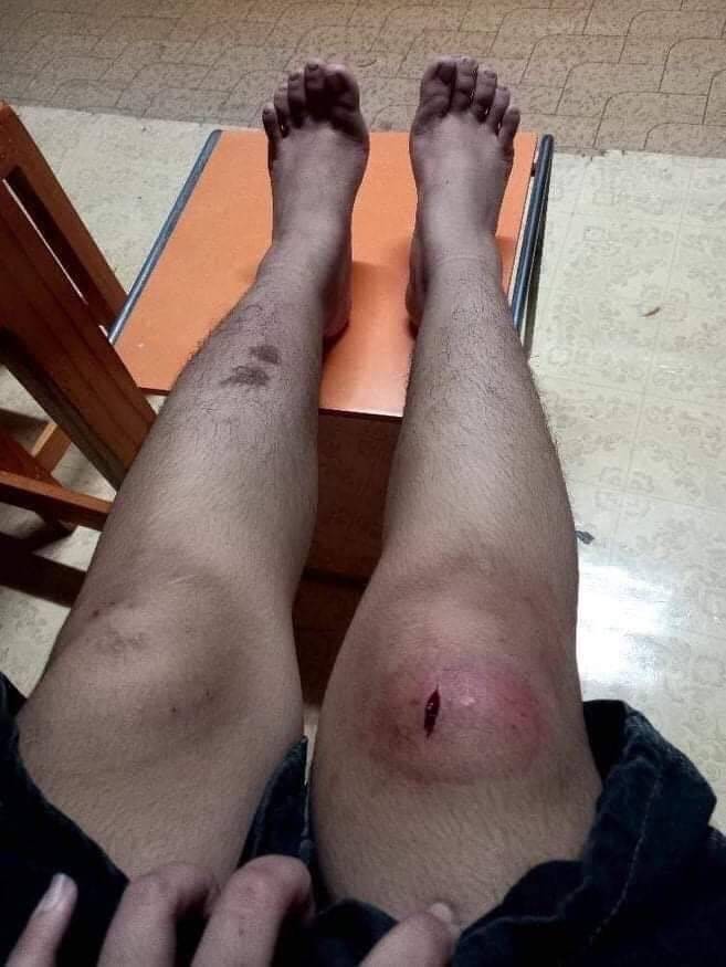 รับน้องโหด รับน้องโหด