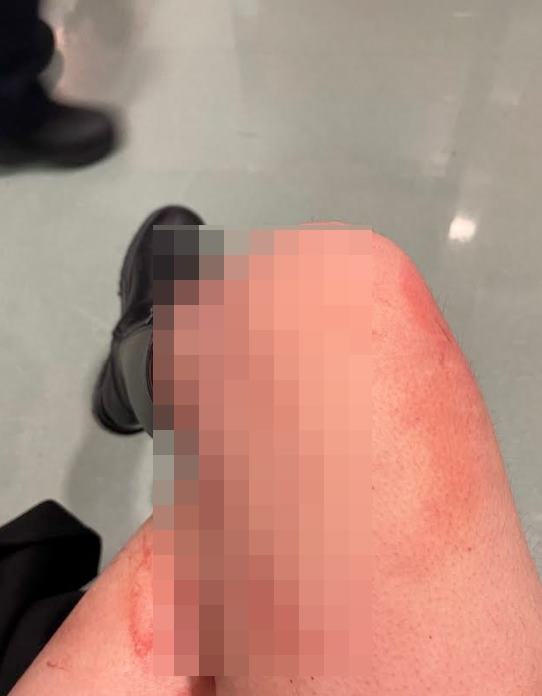 สาวไทยถูกทำร้ายในนิวยอร์ก สาวไทยถูกทำร้ายในนิวยอร์ก