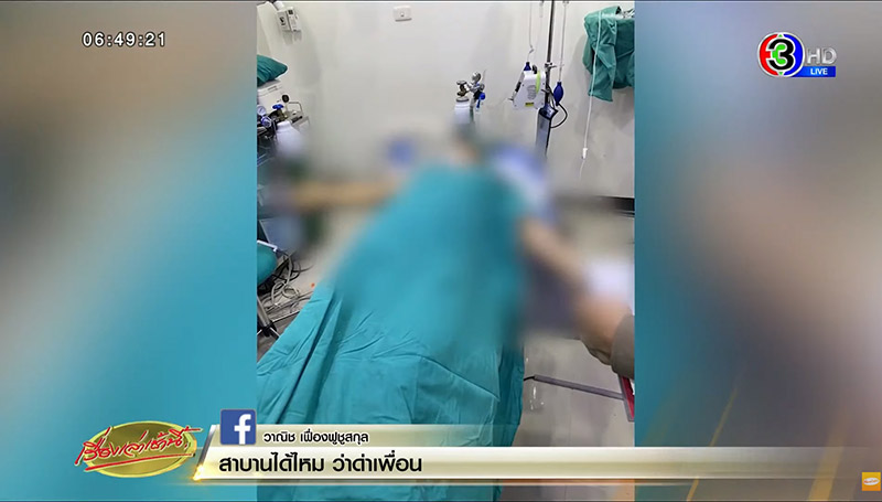 ดูดไขมันเสียชีวิต ดูดไขมันเสียชีวิต