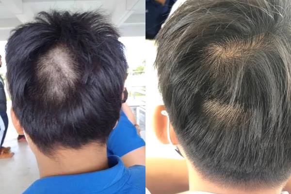 ครูกล้อนผมนักเรียน ครูกล้อนผมนักเรียน