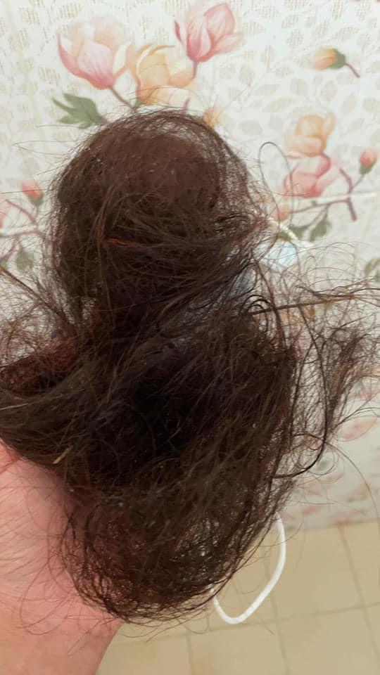 ยืดผม 5 ชั่วโมง ผมร่วงเกือบหมดหัว ยืดผม 5 ชั่วโมง ผมร่วงเกือบหมดหัว