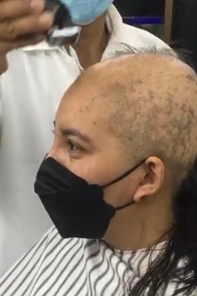 ยืดผม 5 ชั่วโมง ผมร่วงเกือบหมดหัว ยืดผม 5 ชั่วโมง ผมร่วงเกือบหมดหัว