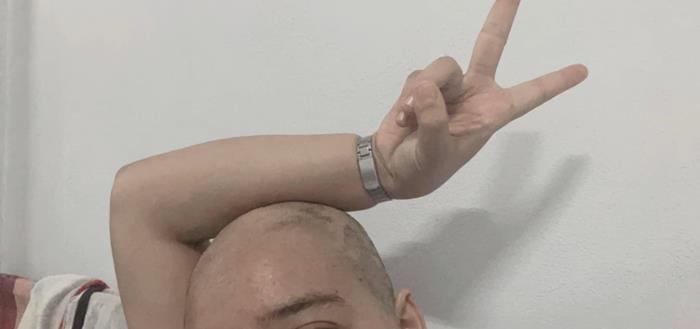 ยืดผม 5 ชั่วโมง ผมร่วงเกือบหมดหัว ยืดผม 5 ชั่วโมง ผมร่วงเกือบหมดหัว