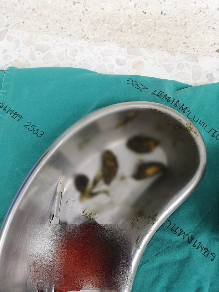 กลืนเม็ดกระท้อนตาย กลืนเม็ดกระท้อนตาย