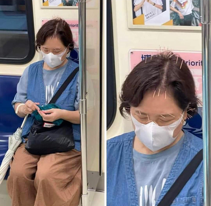 คนอึ้งป้าขึ้นรถไฟฟ้า เข็มเต็มหัวกว่า 30 เล่ม คนอึ้งป้าขึ้นรถไฟฟ้า เข็มเต็มหัวกว่า 30 เล่ม