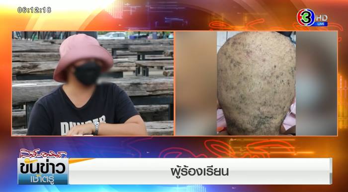 ร้านทำผม จ่อฟ้องกลับ ลูกค้ายืดผมแต่ผมร่วงหมดหัว ร้านทำผม จ่อฟ้องกลับ ลูกค้ายืดผมแต่ผมร่วงหมดหัว