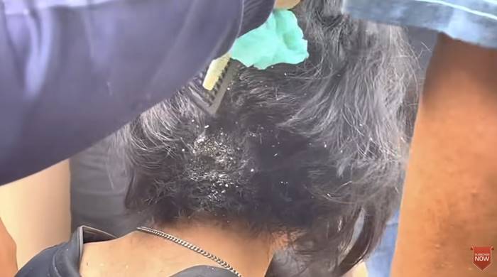 ป่วยแปลก เด็ก 14 ไม่อาบน้ำ ไม่ตัดผม 1 ปี ป่วยแปลก เด็ก 14 ไม่อาบน้ำ ไม่ตัดผม 1 ปี