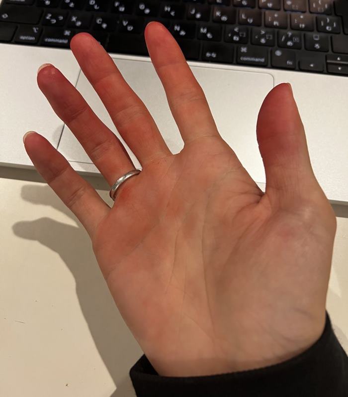 ซักรองเท้าสีตก ซักรองเท้าสีตก