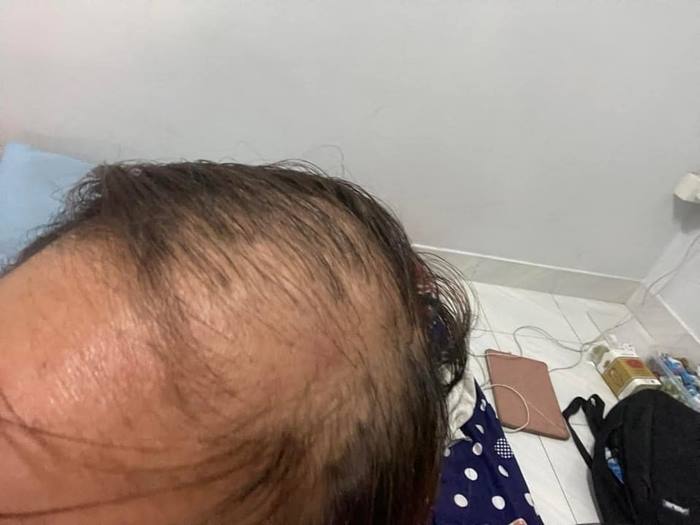 ร้านทำผม จ่อฟ้องกลับ ลูกค้ายืดผมแต่ผมร่วงหมดหัว ร้านทำผม จ่อฟ้องกลับ ลูกค้ายืดผมแต่ผมร่วงหมดหัว