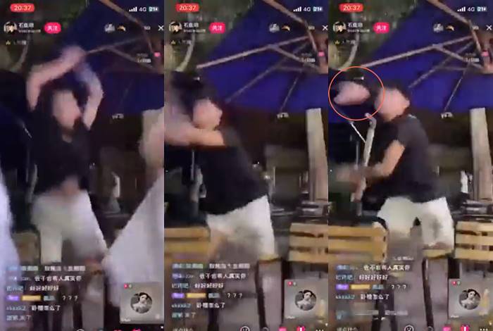 2 หนุ่มหล่อโดนฟัน มือกระเด็น 2 หนุ่มหล่อโดนฟัน มือกระเด็น