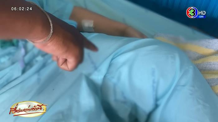 เด็ก ป.6 ถูกครูสั่งลุกนั่ง 150 ครั้ง กระดูกร้าว อดเข้า ม.1 เด็ก ป.6 ถูกครูสั่งลุกนั่ง 150 ครั้ง กระดูกร้าว อดเข้า ม.1