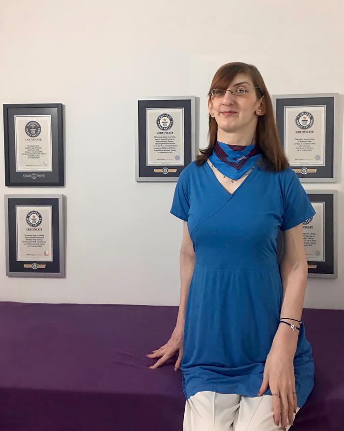 รูเมย์ซา เกลกี ผู้หญิงที่สูงที่สุดในโลก รูเมย์ซา เกลกี ผู้หญิงที่สูงที่สุดในโลก