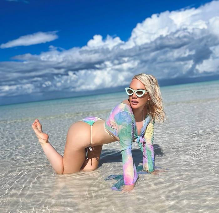 นางแบบโดนตัดขา ติดเชื้อแบคทีเรียกินเนื้อ นางแบบโดนตัดขา ติดเชื้อแบคทีเรียกินเนื้อ