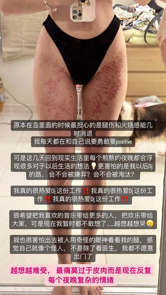 พิษดอกไม้ทะเล พิษดอกไม้ทะเล