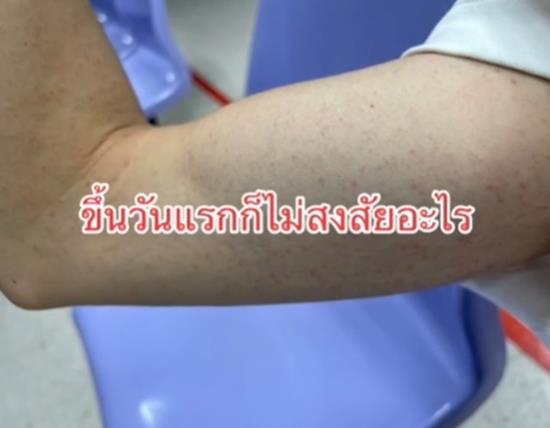 โรคภูมิคุ้มกันเป็นพิษ โรคภูมิคุ้มกันเป็นพิษ