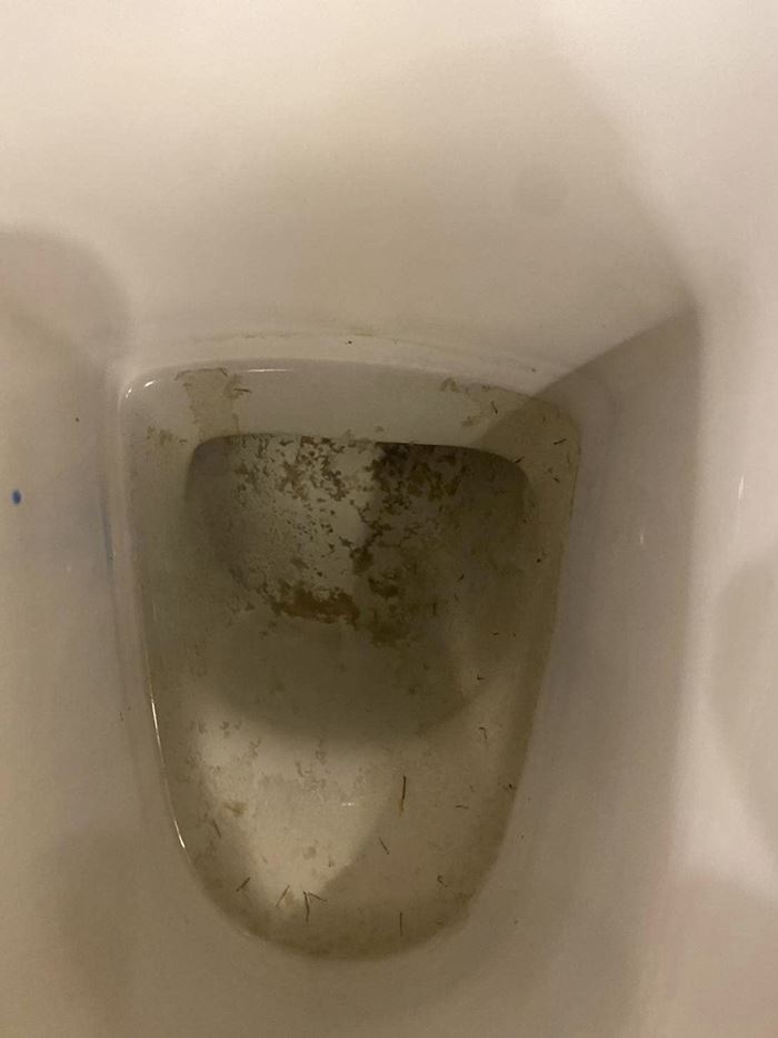 ลูกบ้านคอนโด ตาติดเชื้อ น้ำปนเปื้อน ลูกบ้านคอนโด ตาติดเชื้อ น้ำปนเปื้อน