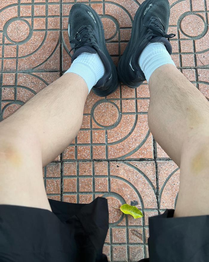 พี่ฮง Oppa Hong รถชน พี่ฮง Oppa Hong รถชน