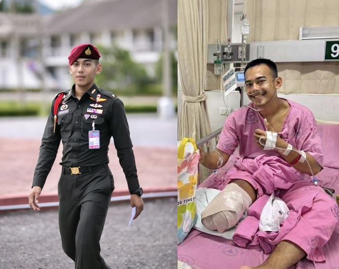 หมวดบุ๊ค ยังยิ้มได้ แม้สูญเสียขา หมวดบุ๊ค ยังยิ้มได้ แม้สูญเสียขา