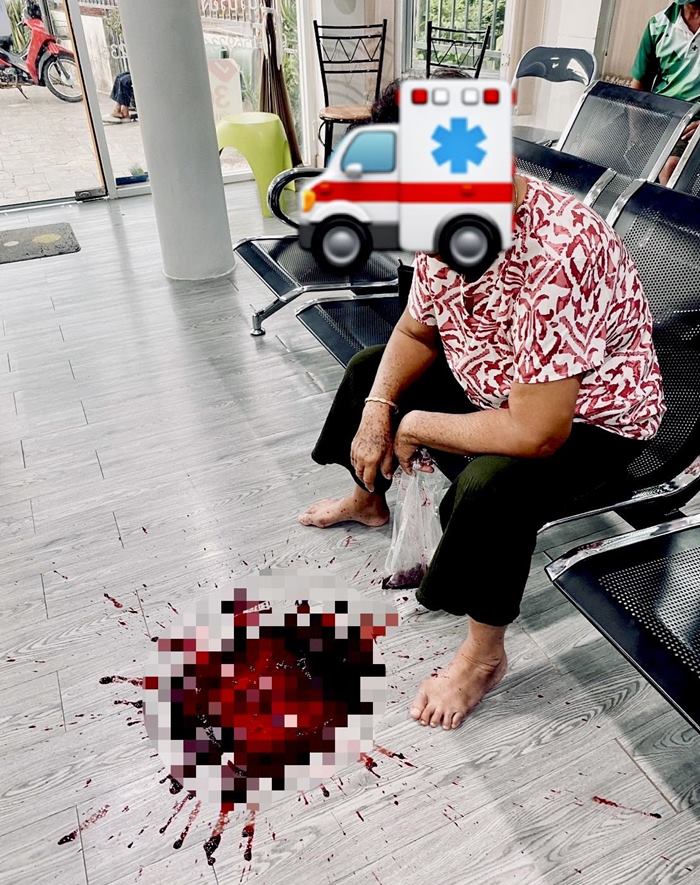 อาเจียนเป็นเลือด เพราะยาแก้ปวดลดอักเสบ อาเจียนเป็นเลือด เพราะยาแก้ปวดลดอักเสบ