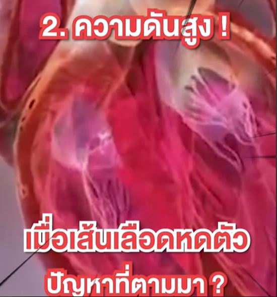 อาบน้ำในหน้าหนาว เสี่ยง เส้นเลือดในสมองแตก อาบน้ำในหน้าหนาว เสี่ยง เส้นเลือดในสมองแตก