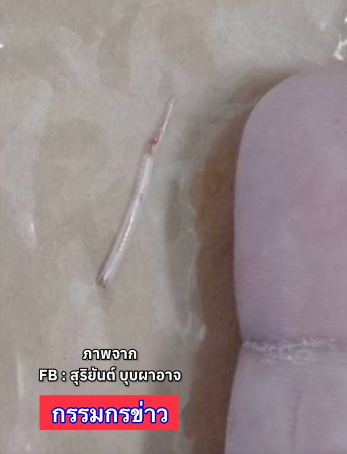 ก้างติดคอ ก้างติดคอ