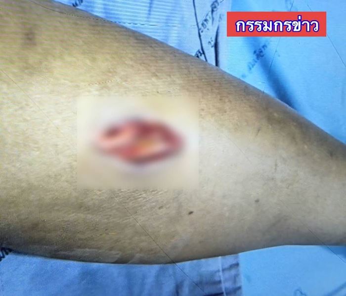 งูจงอางฉก งูจงอางฉก