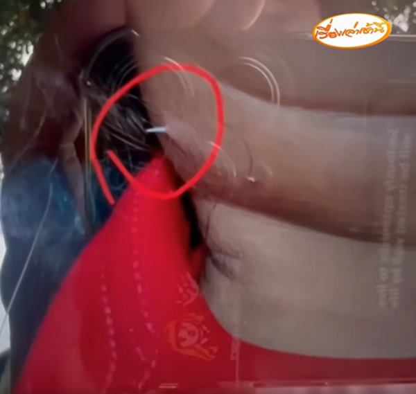 ก้างติดคอ ก้างติดคอ