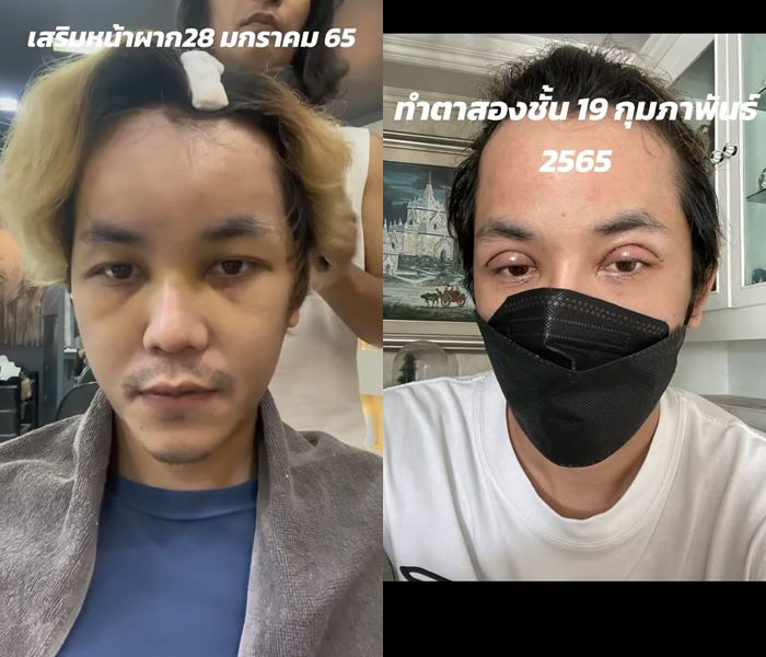 แปลงเพศ หนุ่มหล่อเป็นสาวสวย แปลงเพศ หนุ่มหล่อเป็นสาวสวย