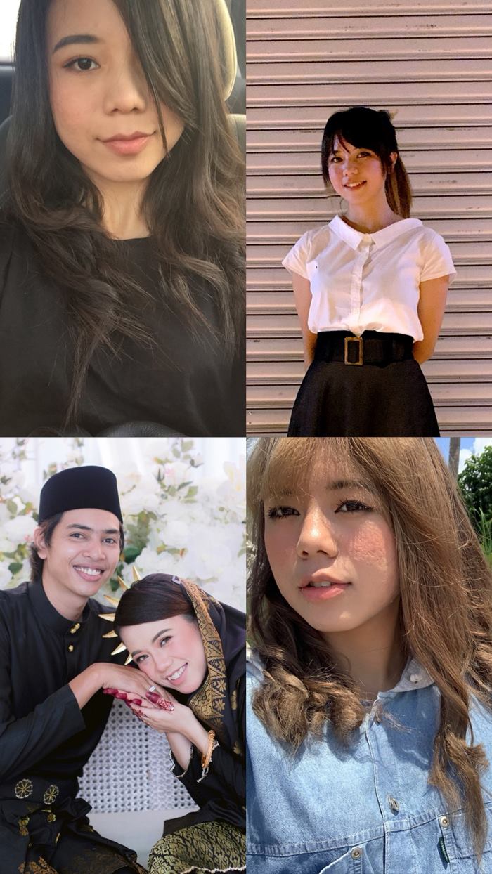 สาวแชร์ประสบการตั้งครรภ์ สิวผุดจนหน้าบวมเป่ง สาวแชร์ประสบการตั้งครรภ์ สิวผุดจนหน้าบวมเป่ง