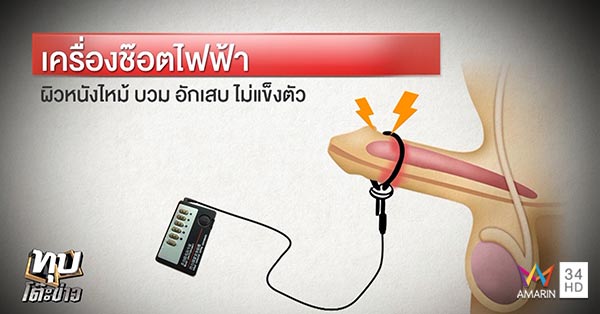 เซ็กส์ทอย เซ็กส์ทอย