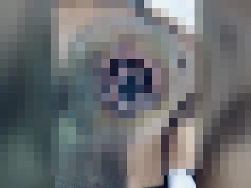 ศัลยกรรมหน้าอก ศัลยกรรมหน้าอก