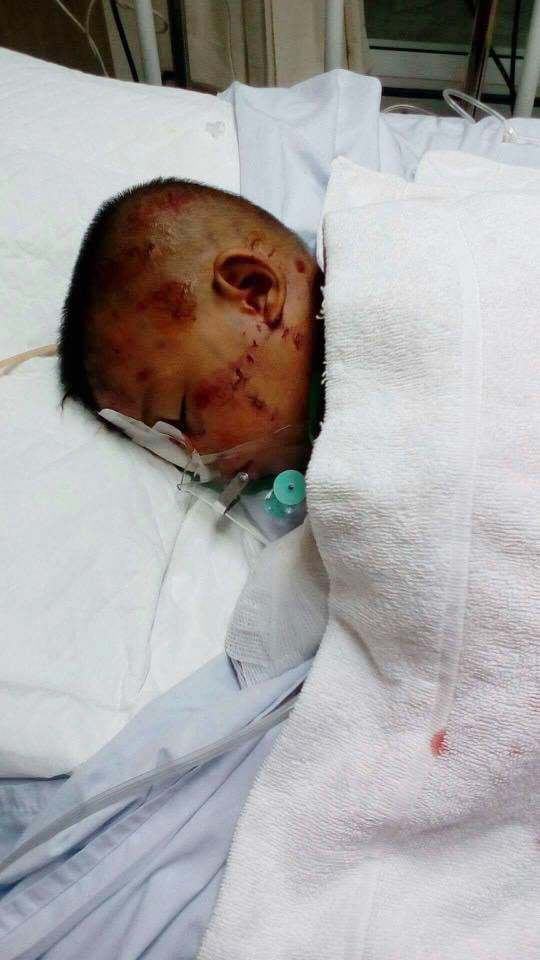 สุนัขกัดคน สุนัขกัดคน