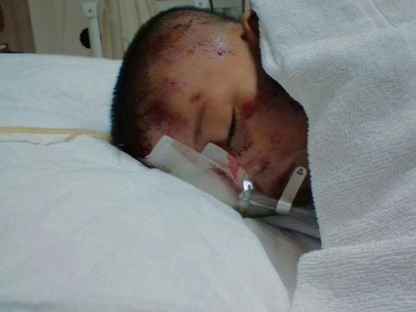 สุนัขกัดคน สุนัขกัดคน