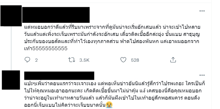 ผมตำเท้า ผมตำเท้า