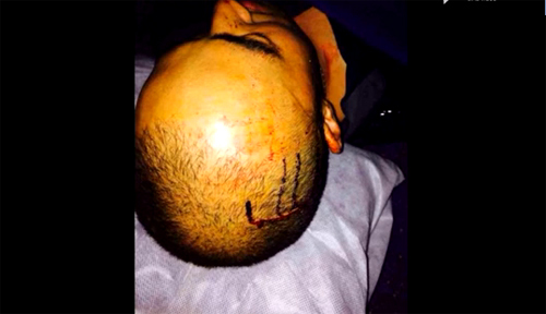 ผู้โดยสารจีนทะเลาะบนเครื่องบิน การบินไทย ผู้โดยสารจีนทะเลาะบนเครื่องบิน การบินไทย