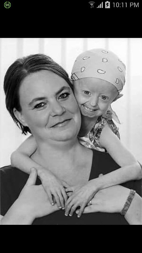 เด็กสาวชาวอังกฤษป่วยโรคแก่ก่อนวัย เสียชีวิตแล้วในวัย 17 ปี เด็กสาวชาวอังกฤษป่วยโรคแก่ก่อนวัย เสียชีวิตแล้วในวัย 17 ปี