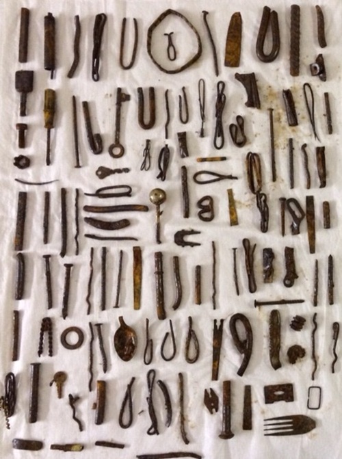 ไม่เชื่อก็ต้องเชื่อ สิ่งที่คุณเห็นเหล่านี้ถูกผ่าออกมาจากท้องมนุษย์ ไม่เชื่อก็ต้องเชื่อ สิ่งที่คุณเห็นเหล่านี้ถูกผ่าออกมาจากท้องมนุษย์