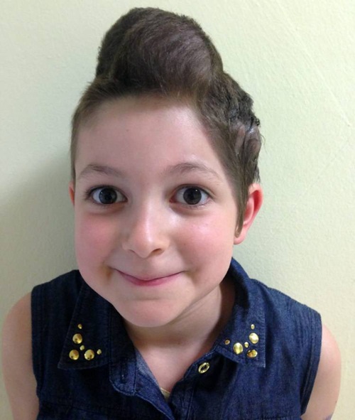 แพทย์ผ่าตัดฝังบอลลูนบนหัวเด็กหญิง แพทย์ผ่าตัดฝังบอลลูนบนหัวเด็กหญิง