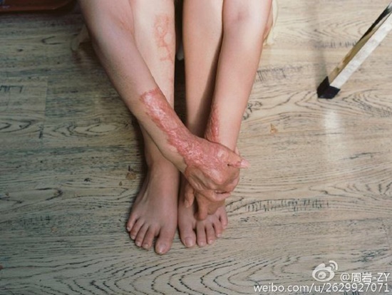 จุดไฟเผา ข่าวต่างประเทศ จุดไฟเผา ข่าวต่างประเทศ