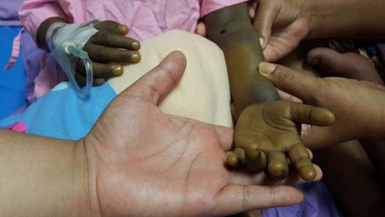 น้องแป้ง หนูน้อยวัย 3 ขวบ ป่วยโรคตับระยะสุดท้าย น้องแป้ง หนูน้อยวัย 3 ขวบ ป่วยโรคตับระยะสุดท้าย