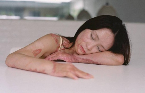 จุดไฟเผา ข่าวต่างประเทศ จุดไฟเผา ข่าวต่างประเทศ